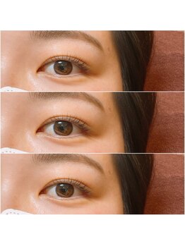 ルアナ(LUANA)/ラッシュリフト