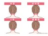  レディース【最新LED美肌脱毛】うなじデザイン脱毛☆