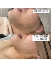 テンパ ビューティー(+10%beauty)/効果写真