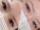 アクロアイトータルビューティ(ACRO eye total beauty)の写真/【高技術】眉パーマ&眉WAXで自分史上最大の魅力を引き出す美眉へ♪お顔の印象が変わる黄金比Styling★