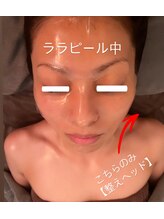 ジーニー(Genie)/ララピール中に整えヘッド