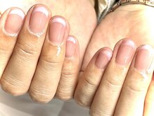 リゲルグロウ 六本木(RIGEL Glow)/スキンフレンチ