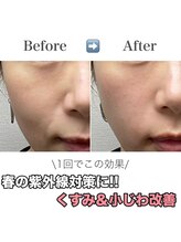 ミムー/before／after