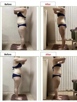 エステティック レイビス 銀座店(RAYVIS)/痩身before＆after