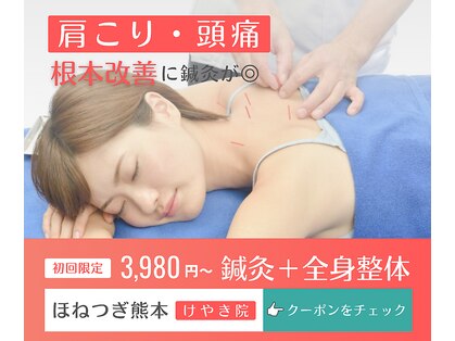 ほねつぎ 平成けやき通り鍼灸接骨院の写真