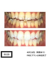 レオン 磐田(REON)/◇ お客様 before＆after ◇
