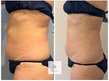 ソナ 大和西大寺院(SONA)/