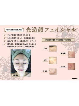 ノノ(nono)の写真/毛穴ケア、シミ、しわ、ニキビでお悩みの方へ☆光フェイシャルで輝く素肌へ!