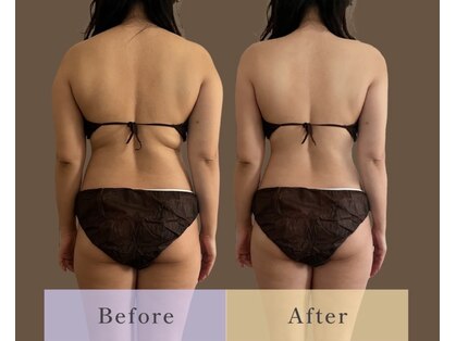 ボディのココチ 品川店(ボディのCOCOCHI)の写真