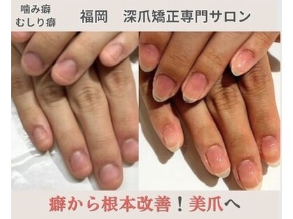 ルソア(LeSoar)の写真