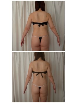 オーブ(Aube)の写真/一生に一度の日のブライダル！ドレス姿を輝かせるエステで、最高の記念日を演出♪