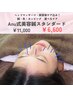 【スタンダード】美容鍼＋選べるケア(鍼・お灸・カッピング)100分 ￥6600