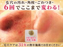サロンドエステケイワイ(de KY)
