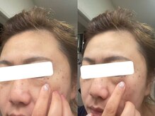 ビューティーラベンダー/