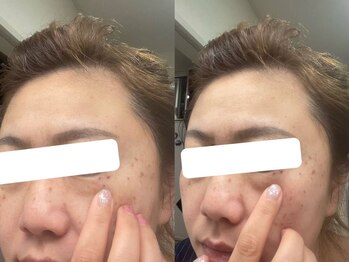 ビューティーラベンダー/