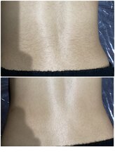 アンジュヴィバラヴィーダ(Ange viva la vida)/★腰毛夏までに綺麗にしたい★