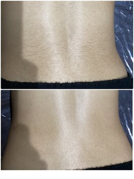 アンジュヴィバラヴィーダ(Ange viva la vida)/★腰毛夏までに綺麗にしたい★