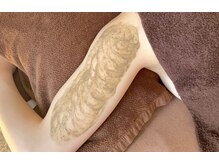 アロー(Allo!)/二の腕ハーブピーリング