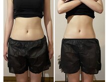 しあわせ腸研究所/腸もみbefore & after