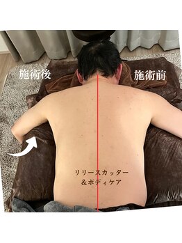 ラクア/リリースカッター後の上半身