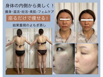 ヨサパーク ポノン(YOSA PARK ponon)の写真/痩せたい方は痩身専門店で本気のダイエット!!ハーブ蒸しLULUONNで「痩せる汗」を流して脂肪燃焼!