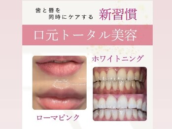 ミモアサロン 岡崎店(mimoaサロン)/口元トータルケアはおまかせ