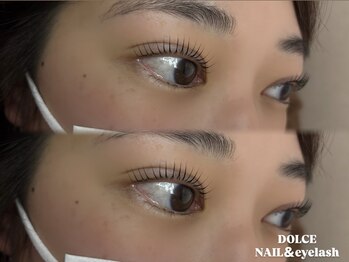 ドルチェ 久留米花畑店(Dolce)/パリジェンヌラッシュリフト