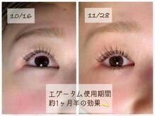 アンジュネス池袋東口店 [マツエク/まつげパーマ/パリジェンヌ/LED/アンドヘルシー]/まつげ美容液　エグータム