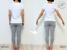 エーアール(AR)/【Before/After】6回目