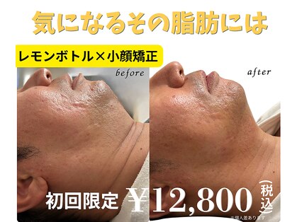 キムスビ(Kimusubi)の写真