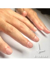 エルシャイン(L-shine)/爪強化