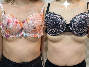 ハレオラ(HaleOla)/お客様の変化☆バストケア