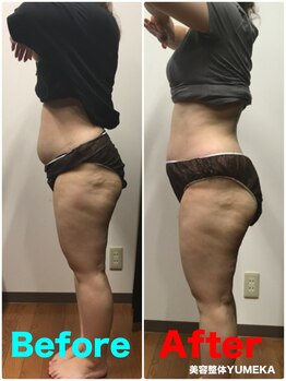 美容整体ユメカ(美容整体YUMEKA)/骨盤ダイエット+骨盤ストレッチ