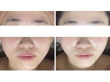 ホワイトアクア 中目黒店(WHITE AQUA)/ララピール