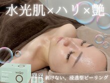 アルゴ 柳川店(ALGO)の雰囲気（韓国で大人気の水光ピール♪フェイシャルメニューも充実◎）