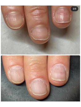 リラフ(Re:laugh)/