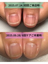 カンパニュラ(Campanula)/たった6回で縦長美爪に♪