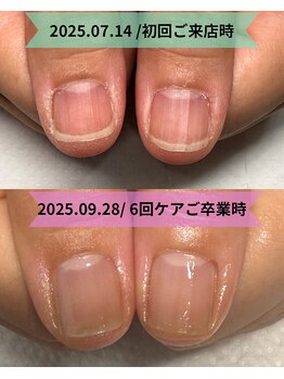 カンパニュラ(Campanula)/たった6回で縦長美爪に♪