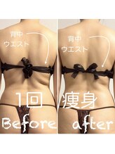 太陽と月/全身痩身×疲労回復！抜群！