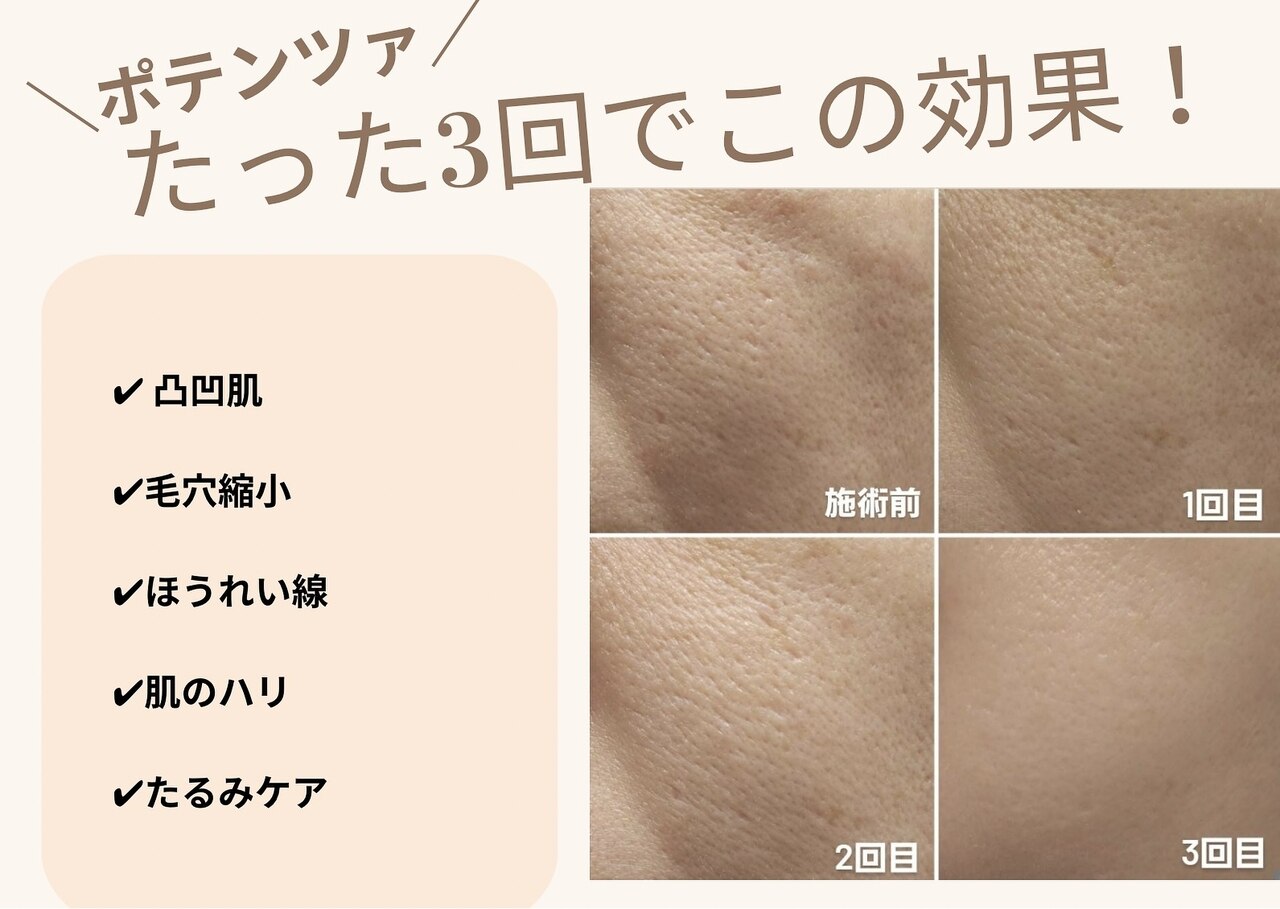 エルマーナ(Lmana)｜ホットペッパービューティー