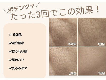 エルマーナ(Lmana)の写真