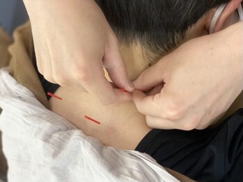 宇都宮オリオン通り整骨院【肩こり/腰痛/産後骨盤矯正/美容鍼/小顔】の写真/丁寧なカウンセリングと高技術で根本原因を見極め、全身の調整から局所まで的確にアプローチします！