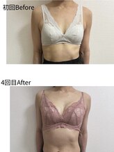 チュラ 大宮店(Chura)/【50代】バストアップ4回目@大宮