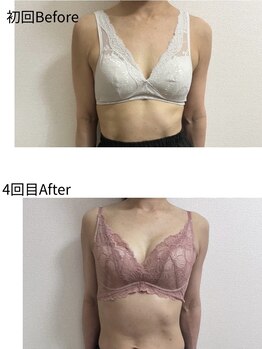 チュラ 大宮店(Chura)/【50代】バストアップ4回目@大宮