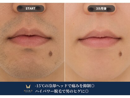 ヒーロー 大名(HERO)の写真