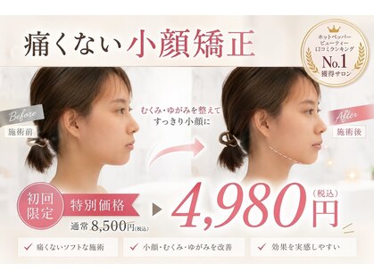 ルミライズヴィブリス(lumirise vibliss)の写真