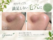 エステティックサロン グリーンアイ 浦和店(green.i)