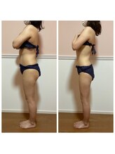 トータル フィルシャイン(Total Fillshine)/ダイエットモニター様