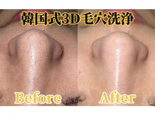 サロンドカスケード(salon de cascade)の雰囲気（黒ずみ毛穴サヨウナラ！毛穴に悩んでいる方必見★最新毛穴洗浄♪）