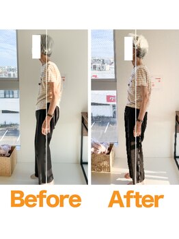 整体院ひなた 都城院/70代女性でも変わります！